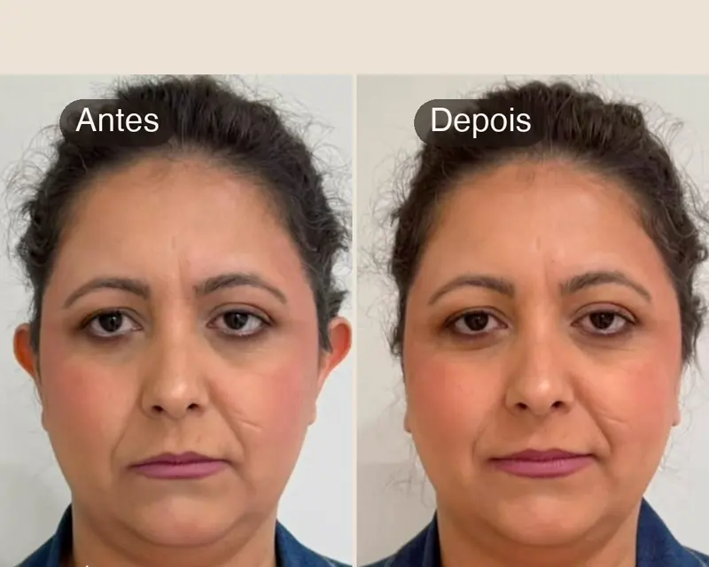 Antes e depois de otomodelação em paciente da clínica